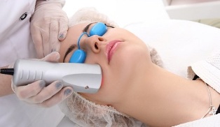 Laser facial skin rejuvenation